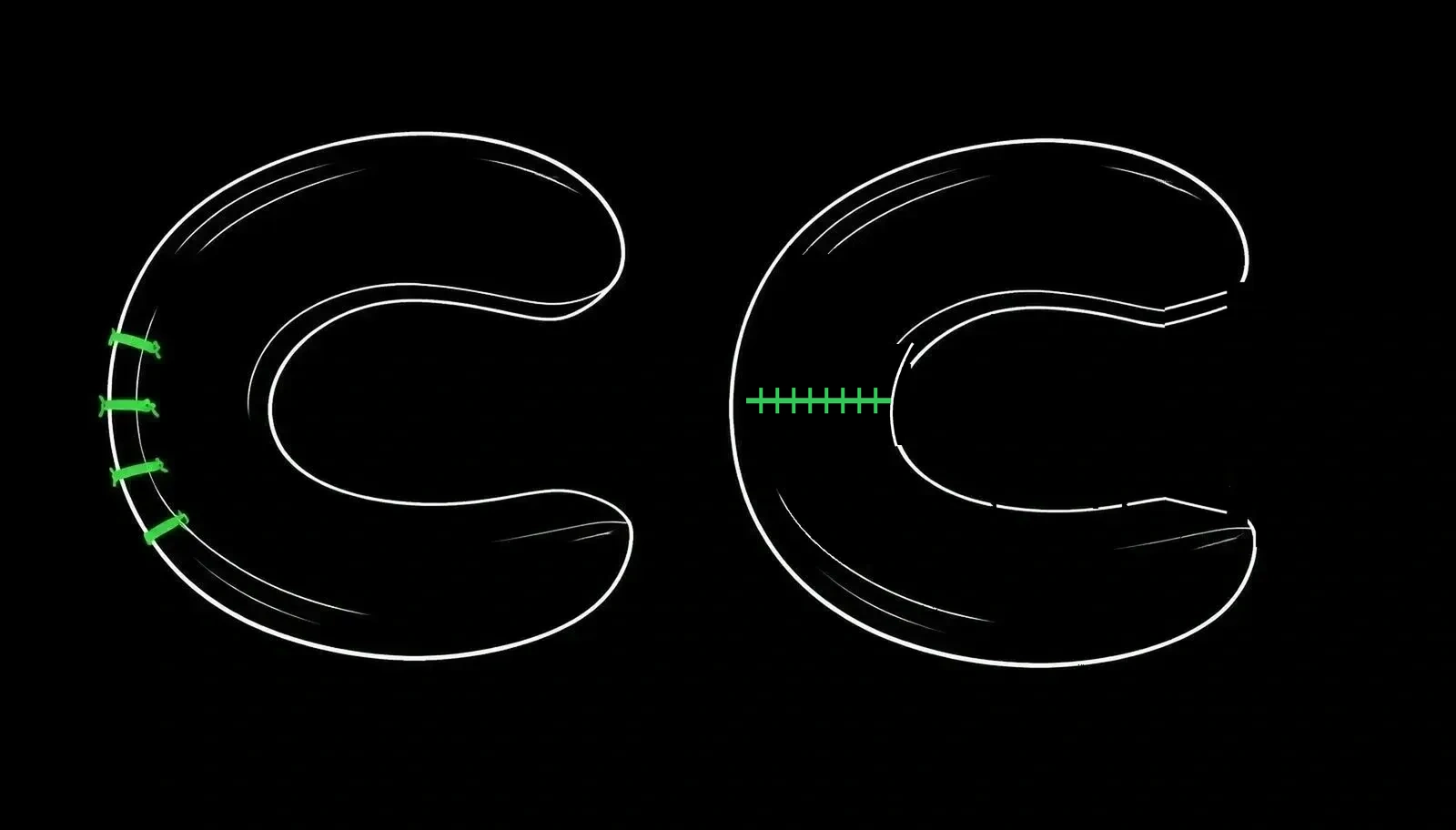 Two C-shaped meniscus outlines side by side, one stitched together with bright green sutures and one with a small wedge of the rim trimmed away in bright green