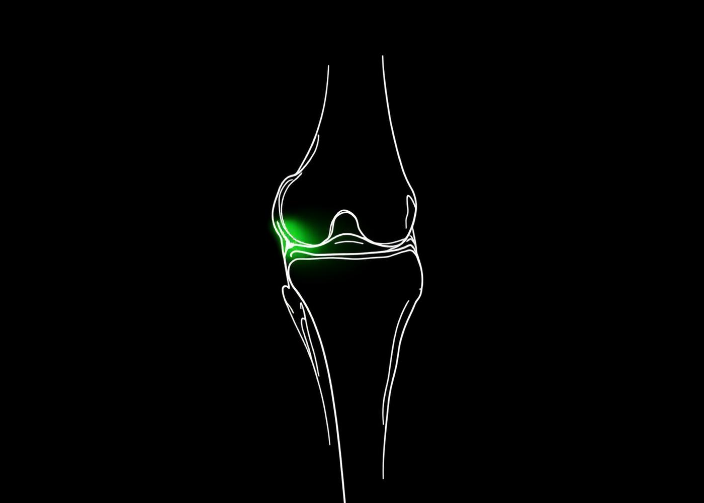 Anatomy of the human knee